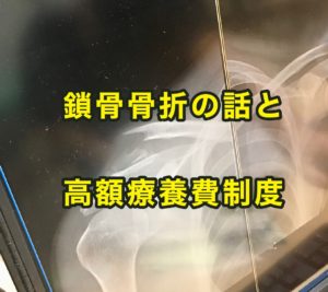 鎖骨骨折手術と高額療養費制度：医療保険は必要？
